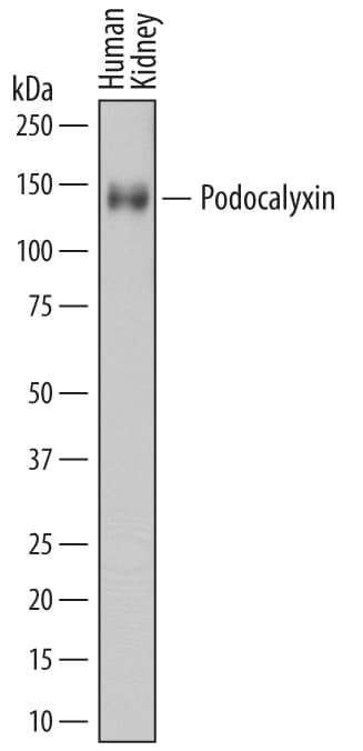 Detection of Human Podocalyxin antibody by Western Blot.