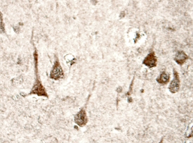 Presenilin‑1 antibody in Human Brain by Immunohistochemistry (IHC-P).