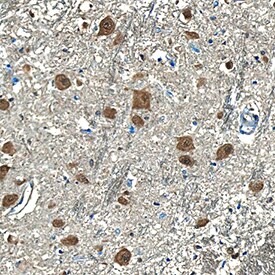 Presenilin-1 antibody in Human Brain by Immunohistochemistry (IHC-P).