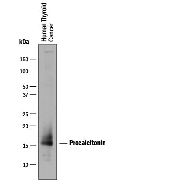 Detection of Human Procalcitonin antibody by Western Blot.