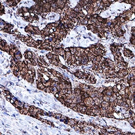 Procalcitonin antibody in Human Thyroid by Immunohistochemistry (IHC-P).