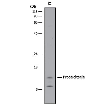 Detection of Human Procalcitonin antibody by Western Blot.