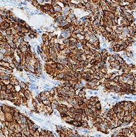 Procalcitonin antibody in Human Thyroid by Immunohistochemistry (IHC-P).