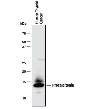 Detection of Human Procalcitonin antibody by Western Blot.