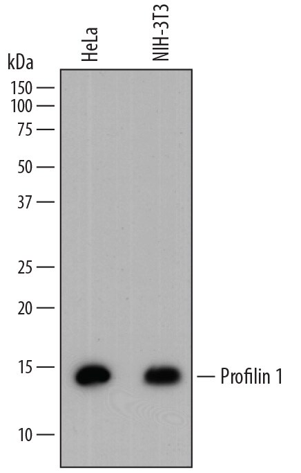 Detection of Human and Mouse Profilin 1 antibody by Western Blot.