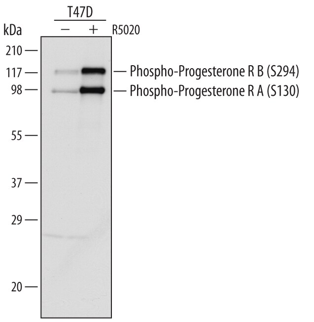 Detection of Human Phospho-Progesterone RB (S294) and Phospho-Progesterone RA (S130) antibody by Western Blot.