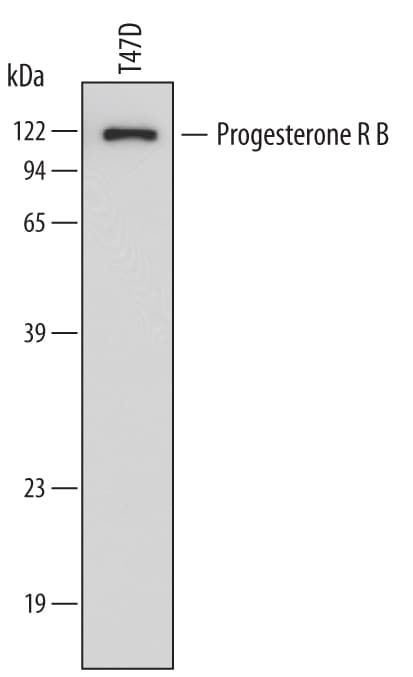 Detection of Human Progesterone R B/NR3C3 antibody by Western Blot.