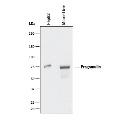 Detection of Human and Mouse Progranulin/PGRN antibody by Western Blot.