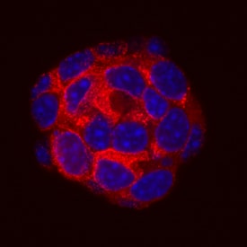 Proinsulin antibody in  beta TC-6 Mouse Cell Line by Immunocytochemistry (ICC).