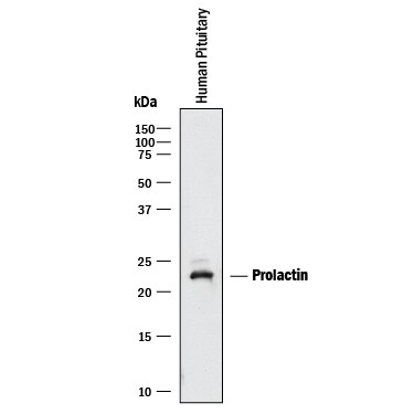 Detection of Human Prolactin antibody by Western Blot.