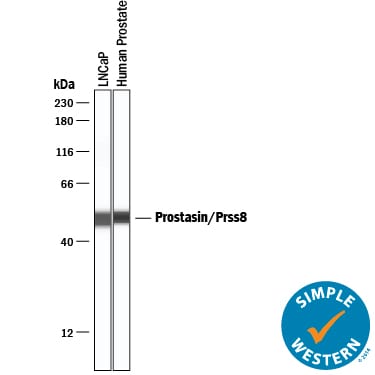Detection of Human Prostasin/Prss8 antibody by Simple WesternTM.