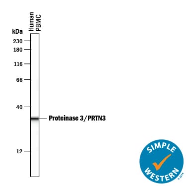 Detection of Human Proteinase 3/Myeloblastin/PRTN3 antibody by Simple WesternTM.