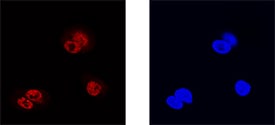 Prox1 antibody in HepG2 Human Hepatocellular Carcinoma Cell Line by Immunocytochemistry (ICC).