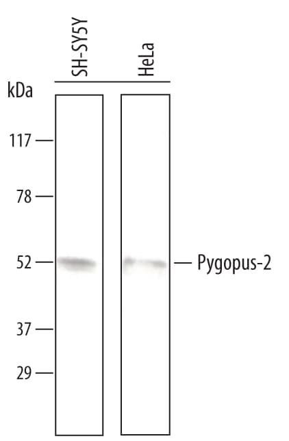 Detection of Human Pygopus‑2 antibody by Western Blot.