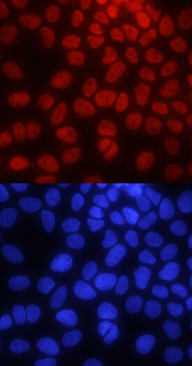 Pygopus-2 antibody in MCF-7 Human Cell Line by Immunocytochemistry (ICC).