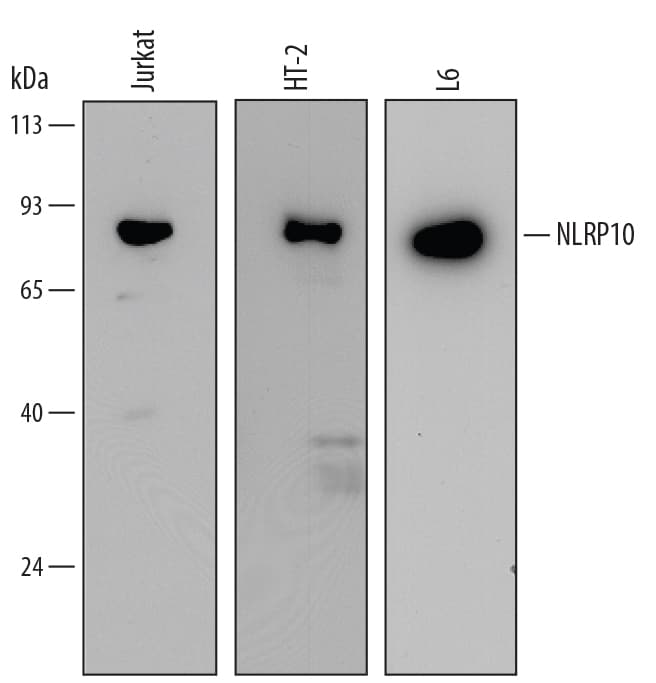 Detection of Human, Mouse, and Rat NLRP10/Pynod/NALP10 antibody by Western Blot.