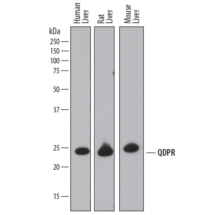 Detection of Human, Mouse, and Rat QDPR antibody by Western Blot.