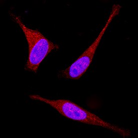 RACK1 antibody in HeLa Human Cell Line by Immunocytochemistry (ICC).