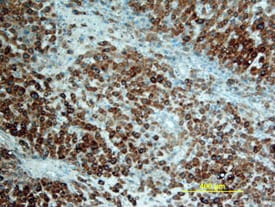 RANK/TNFRSF11A antibody in Human Liver by Immunohistochemistry (IHC-P).