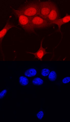 RB1 antibody in MCF-7 Human Cell Line by Immunocytochemistry (ICC).