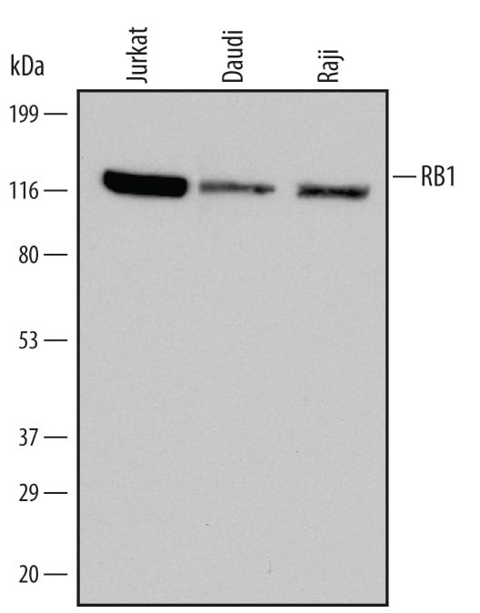 Detection of Human RB1 antibody by Western Blot.