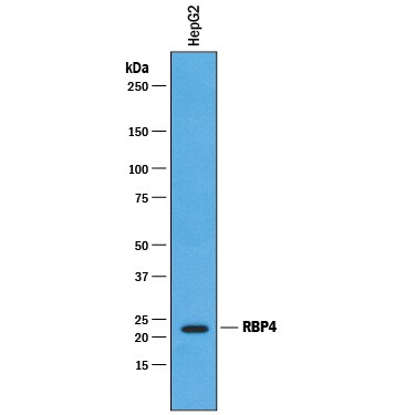 Detection of Human RBP4/Retinol‑Binding Protein 4 antibody by Western Blot.