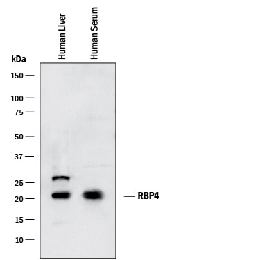 Detection of Human RBP4/Retinol‑Binding Protein 4 antibody by Western Blot.