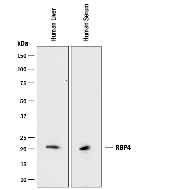 Detection of Human RBP4/Retinol‑Binding Protein 4 antibody by Western Blot.