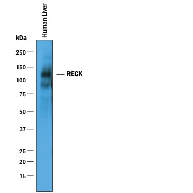 Detection of Human RECK antibody by Western Blot.