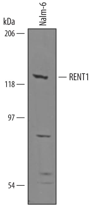 Detection of Human RENT1/UPF1 antibody by Western Blot.