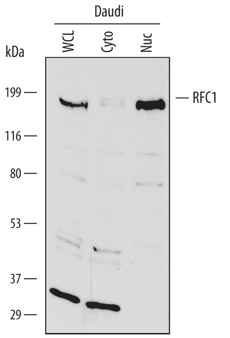 Detection of Human RFC1 antibody by Western Blot.
