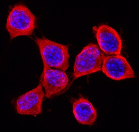 RGM-B antibody in Neuro-2A Mouse Cell Line by Immunocytochemistry (ICC).
