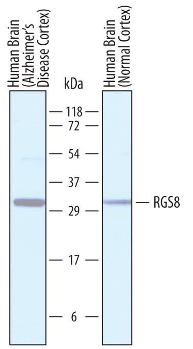 Detection of Human RGS8 antibody by Western Blot.