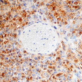 RIPK3/RIP3 antibody in Human Spleen by Immunohistochemistry (IHC-P).