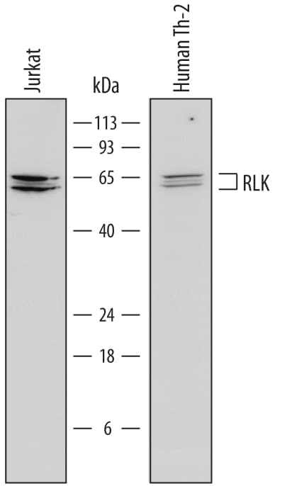 Detection of Human RLK/TXK antibody by Western Blot.