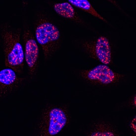 RNF168 antibody in HeLa Human Cell Line by Immunocytochemistry (ICC).
