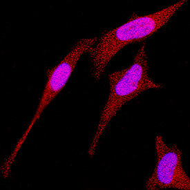 RNF4 antibody in HeLa Human Cell Line by Immunocytochemistry (ICC).