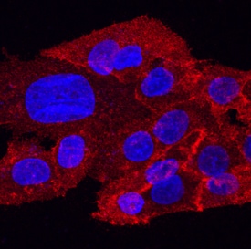 ROBO1 antibody in HepG2 Human Cell Line by Immunocytochemistry (ICC).