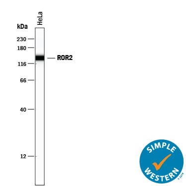 Detection of Human ROR2 antibody by Simple WesternTM.