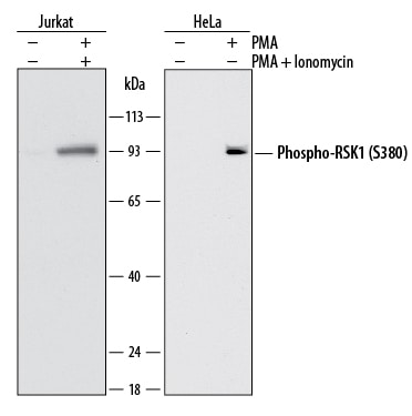 Detection of Human Phospho-RSK1 (S380) antibody by Western Blot.