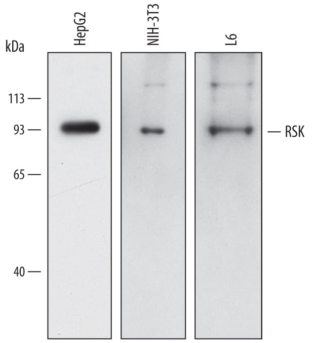 Detection of Human, Mouse, and Rat RSK antibody by Western Blot.