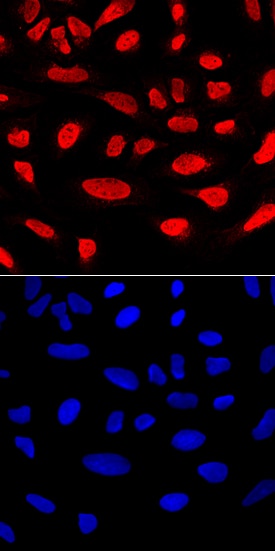 RUNX2/CBFA1 antibody in U2OS Human Cell Line by Immunocytochemistry (ICC).