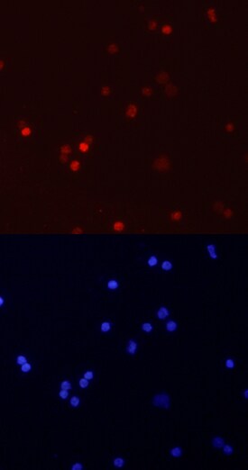 RUNX3/CBFA3 antibody in Human PBMCs by Immunocytochemistry (ICC).
