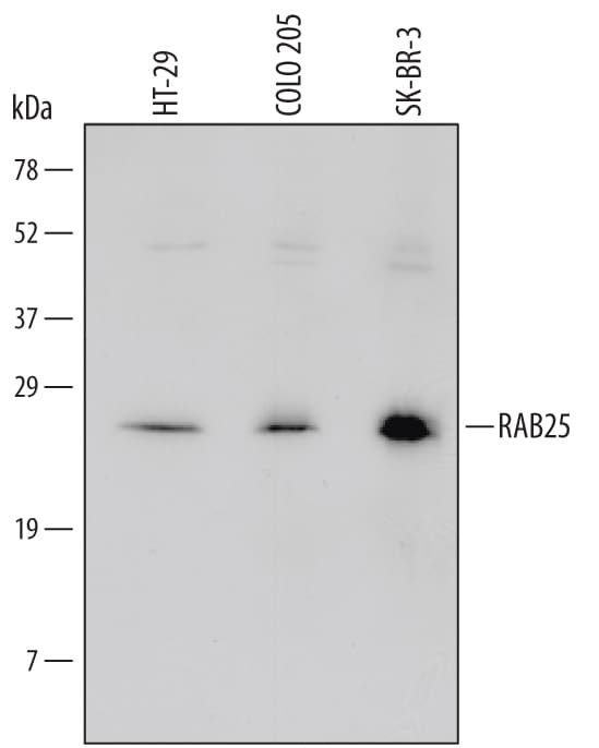 Detection of Human RAB25 antibody by Western Blot.