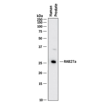 Detection of Human Rab27a antibody by Western Blot.