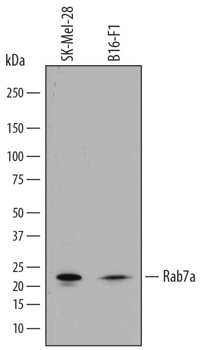 Detection of Human and Mouse Rab7a antibody by Western Blot.