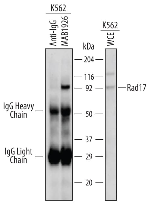 Immunoprecipitation of Human Rad17.