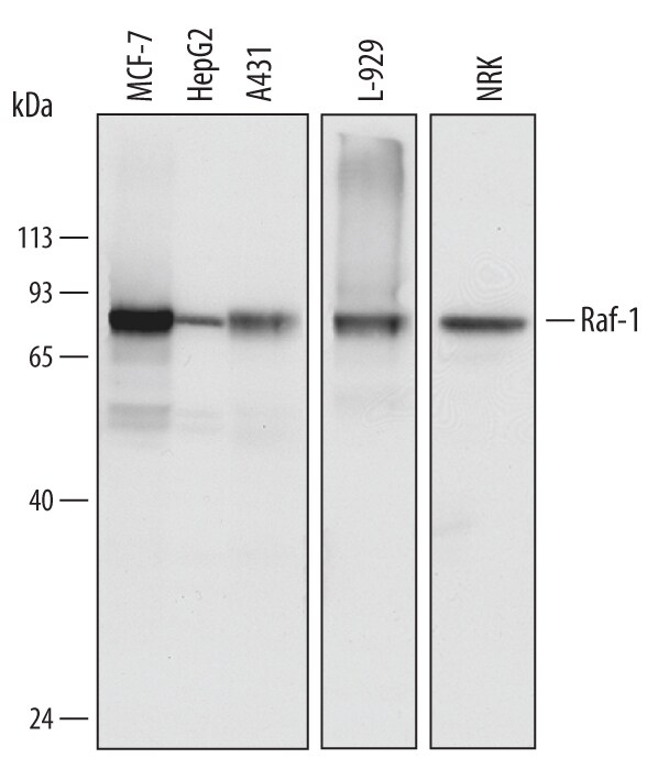 Detection of Human, Mouse, and Rat Raf‑1 antibody by Western Blot.