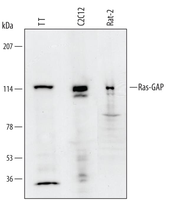 Detection of Human/Mouse/Rat Ras-GAP antibody by Western Blot.