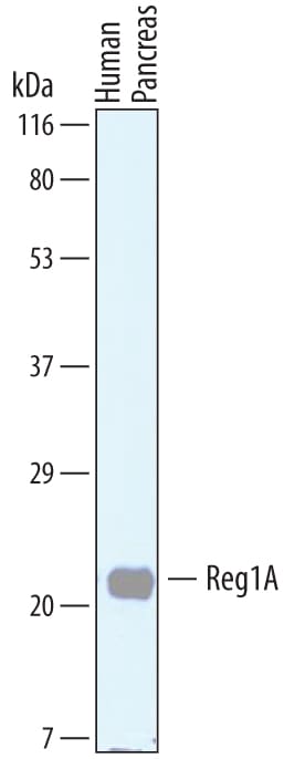 Detection of Human Reg1A antibody by Western Blot.
